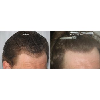 Before and after dry hairs 3